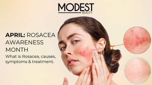 Shedding Light During Rosacea Awareness Month - Modest Beauty Skincare